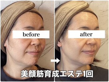 リエル(RIEL)/小顔矯正×美顔筋育成エステ