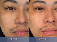 カズキ ハギワラ(Kazuki Hagiwara)/クリスティーナ当日ビフォアフ