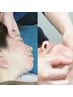 小顔リフトアップフェイシャル｜小顔&リフトUP｜通常￥27000