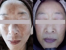 サロンドアモール(Salon de a mole)の雰囲気（【結果に自信あり◎】本気のシミケアで見た目年齢層大幅ダウン！）