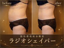 痩身特化サロン Theory【セオリー】