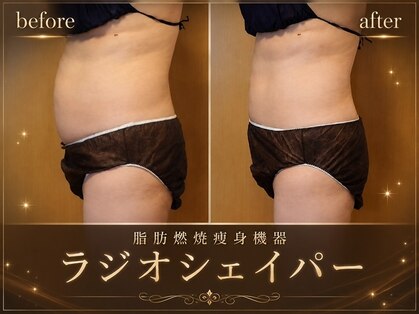 セオリー(Theory)の写真