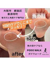 ポドウオーク(PODO WALK)/魚の目ケアします！