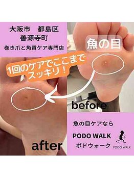 ポドウオーク(PODO WALK)/魚の目ケアします！
