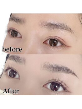 キンキー 広島(kinky)/