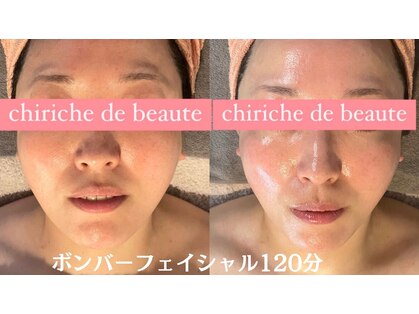 チリッシュドゥボーテ(chiriche de beaute)の写真