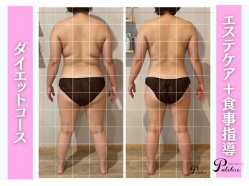 プルクレ 常磐町店(Pulchre)/ダイエットコース♪40代