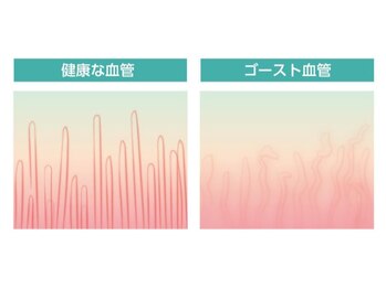 ぷめはな整体/血管の変化