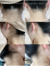 エムズスタイル ネイルバー(M's Style NAIL BAR)/うなじ脱毛