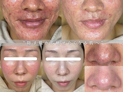 ウニカ(Unica)の写真