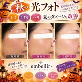アンベリールプラス(embellir+)