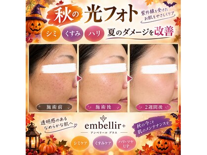 アンベリールプラス(embellir+)の写真
