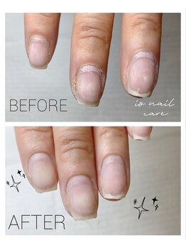 イオネイル(io nail)/【HAND】甘皮ケア【ハンドケア】