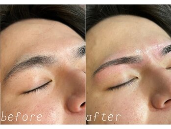 ボス 名古屋店(BOSS)/Before&After6 #メンズ脱毛#眉毛