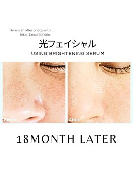 ハグミー 甲子園口(HUGME.)/毛穴/若見え/小顔/美肌