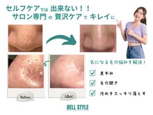 ベルスタイル(Bell style)の雰囲気（『ホームケアでは難しい』気になる黒ずみを当店で即改善◎）