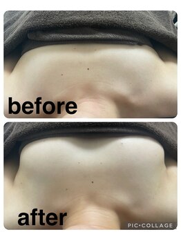 ギンザアール(GINZA R.)/バストアップ♪