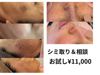 リリアン(Rilian)の写真