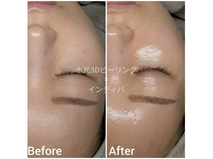 リガーベル(Regerbel)の写真