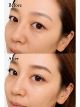 テンカラーズ アイ 五反田(10COLORS)/アイブロウ　まつ毛パーマ