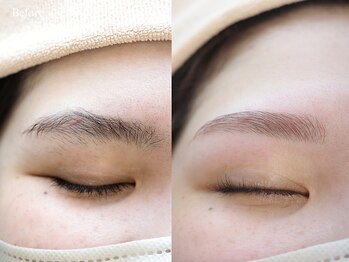 エンカシェット 代官山(En’e cachette)/【矯正美眉】自信のある目元に◎