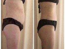 ルラシェ/ダイエットサポート