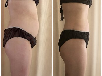 ルラシェ/ダイエットサポート