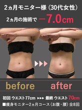 蓮子の夢/2ヶ月でウエスト－7cm！