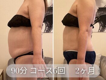 ラシクビューティーサロン(LACHIC BEAUTY SALON)