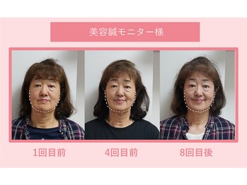 グリーンノア鍼灸院/