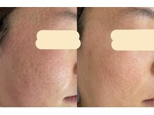 エスポワール(espoir)/before・after