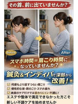 フィットジユウガオカ(Fit_Jiyugaoka)/肩こり、亀首に新しい不調ケア