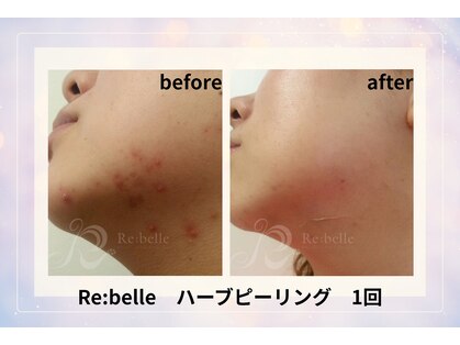 サロン ド ボーテ ラニ 戸塚店(LANI)の写真