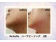 サロン ド ボーテ ラニ 戸塚店(LANI)の写真