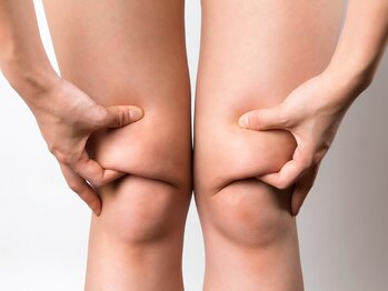 クレナ イオンゆみ~る鎌取店(Crena)/ヒザ上の脂肪は老けて見える事も