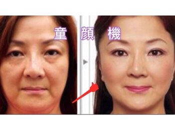東洋経絡エステ アンド リラクゼーション/童顔機