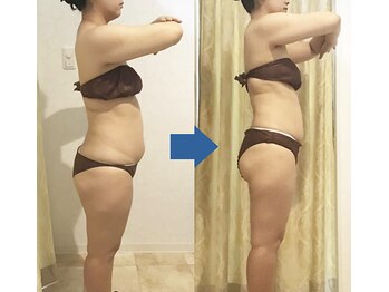 ピュアトゥルー 岐阜西店(PureTrue)/余分なお肉に高周波！ラジオ派！