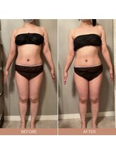 リファラ 光の森店(REFALA)/【痩身/20代女性】約3ヶ月の結果