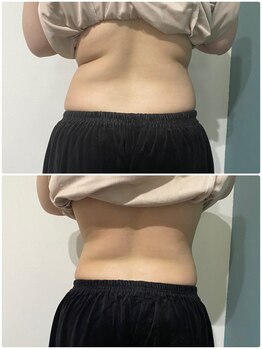 OBS/腰肉撃退/本気ダイエット