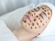 モアビューティー 庚午店(MORE BEAUTY)の写真/《毛穴専門サロン》【肌質改善】毛穴洗浄×幹細胞入ハーブピーリング¥18500→¥9800★