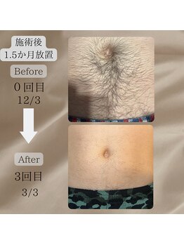 ネイチャー(Nature)/【お腹BeforeAfter】