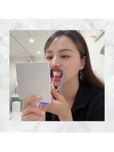 ホワイトニングショップ 下関店/歯茎に、ワセリンを塗ります。