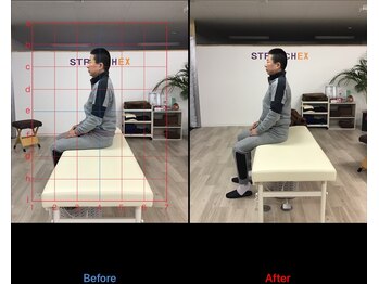 ストレチックス 近江八幡店/BeforeAfter