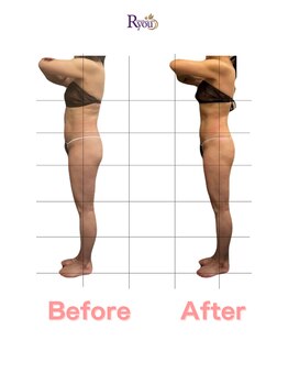 アールユー ギンザ(Ryou ginza)/しつこい凸凹も撃退