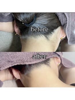 スマイルネイル(SMILE NAIL)/