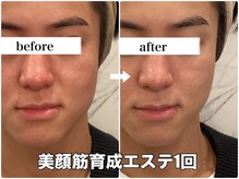 リエル(RIEL)/小顔矯正×美顔筋育成エステ