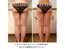 痩身/ダイエット/ハーブ蒸し/水素/リンパマッサージ/ブライダル