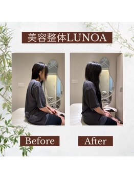 美容整体LUNOA　神戸三宮院/痛みも美も叶える本格美容整体