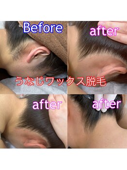 ルミエール(LUMIE’RE)/うなじWax脱毛