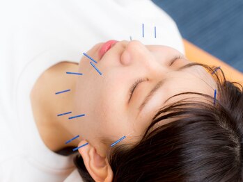 たんぽぽ鍼灸整骨院/施術風景